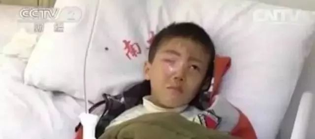 孩子眼球20分钟被熔化,6岁孩子眼球10分钟被融化