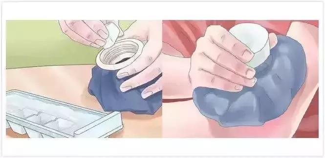 为什么你的身上会无缘无故出现淤青?这4种情况最要命