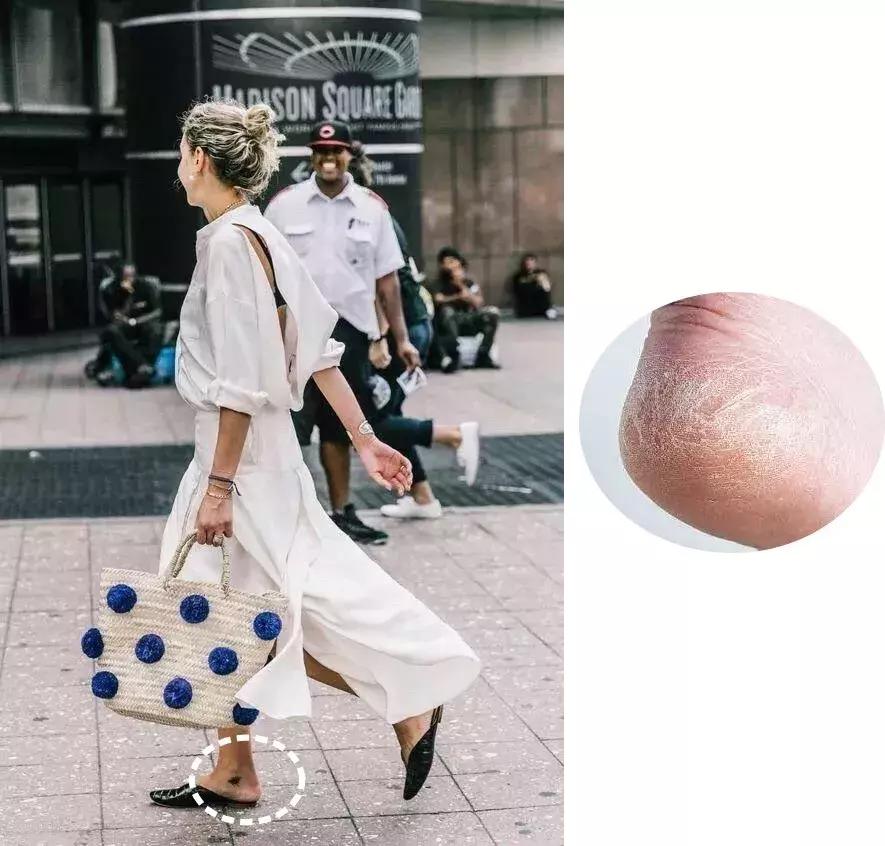 这双鞋火成这样，但我劝你别买！