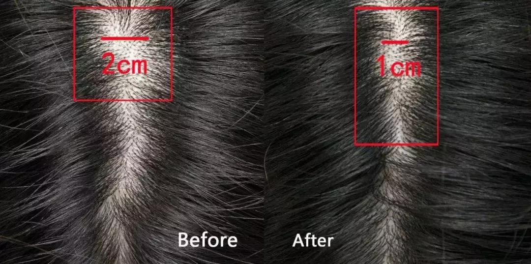 贝嫂和小贝早期采访,贝嫂和小贝相差几岁