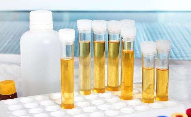 小孩尿很臭是不是生病？家长你会看尿识病吗？