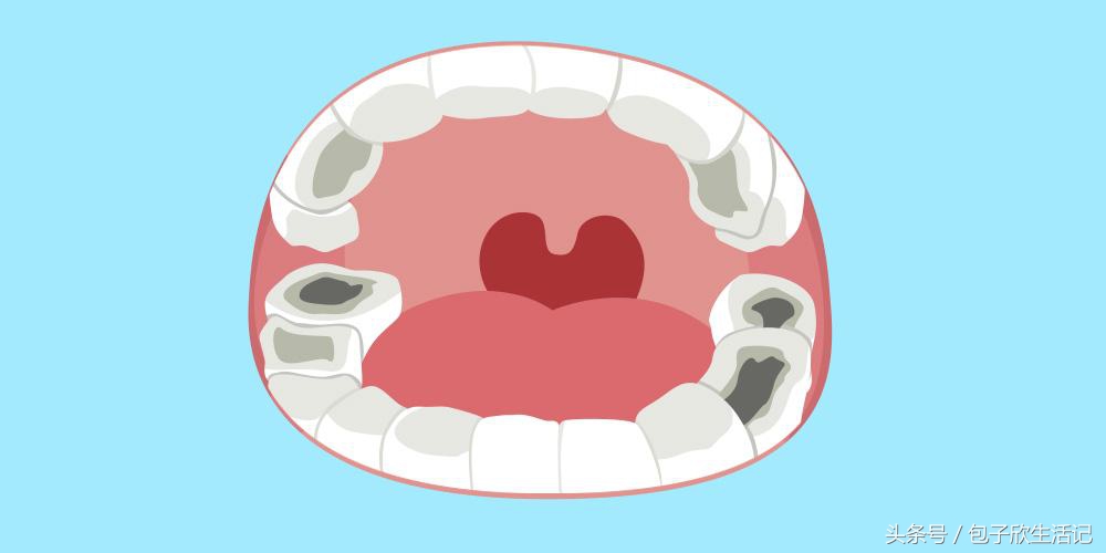 如何防止龅牙和地包天,奶瓶怎么喂防止地包天龅牙