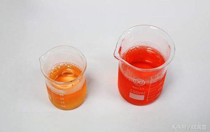 为什么尿路感染就会有血尿,尿路感染为什么会有血尿