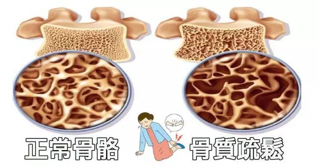 乳腺癌内分泌疗法的副作用有哪些,芳香化酶抑制剂男性乳腺癌