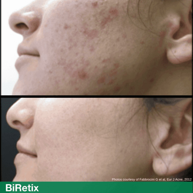 西班牙国宝级药妆,西班牙药妆全部产品