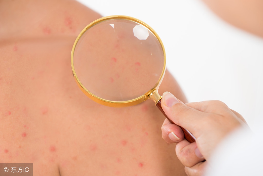 儿童基因检测常检项目有哪些?做什么项目实用?