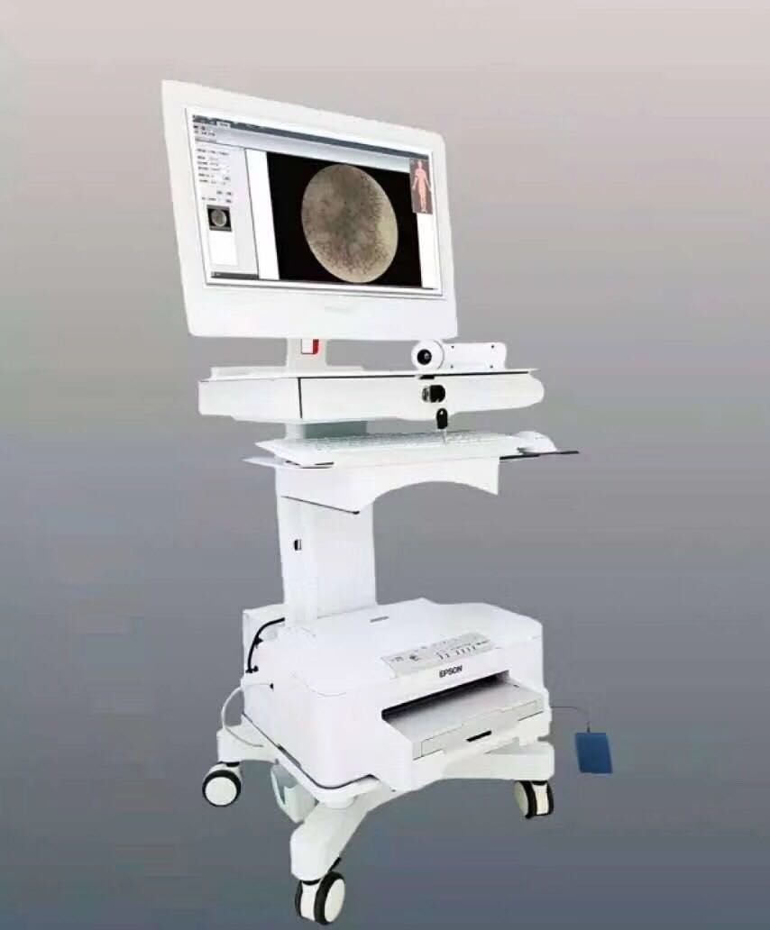 皮肤科皮肤镜检查多少钱,皮肤科的皮肤镜是什么