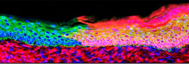 《自然》：太神了！科学家通过重编程得到皮肤干细胞，首次实现大面积创口原位皮肤再生｜科学大发现
