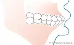 小孩吃饭慢吞吞老是含在嘴里,幼儿吃饭含在嘴里不咽的原因分析