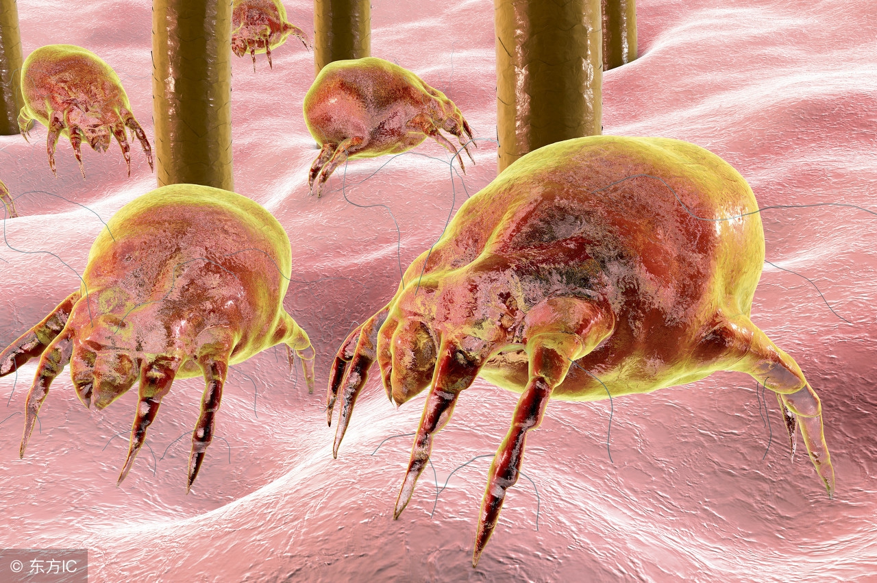 只要放在床上就能去螨虫的东西,螨虫克星帮你赶掉螨虫