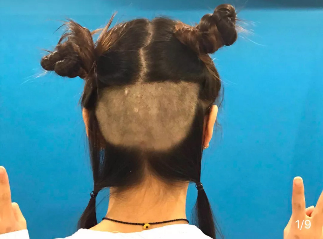 修理发际线男士,男生要不要修发际线