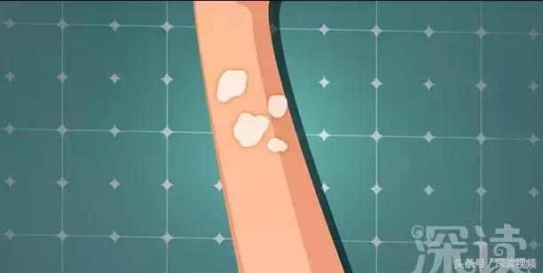 海边游泳晒红了怎么补救,海滩游泳后皮肤起红点