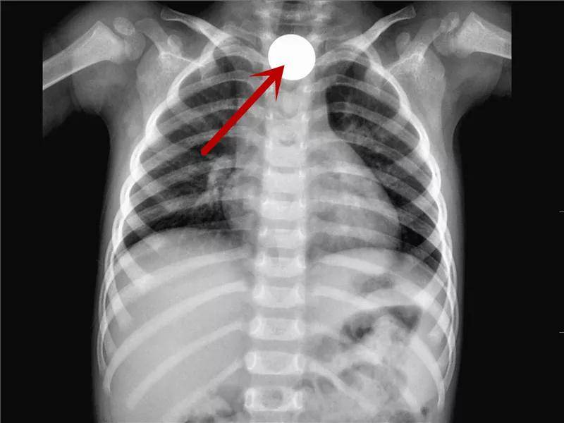 一些让人毛骨悚然拍到的照片,六个令人毛骨悚然的影像