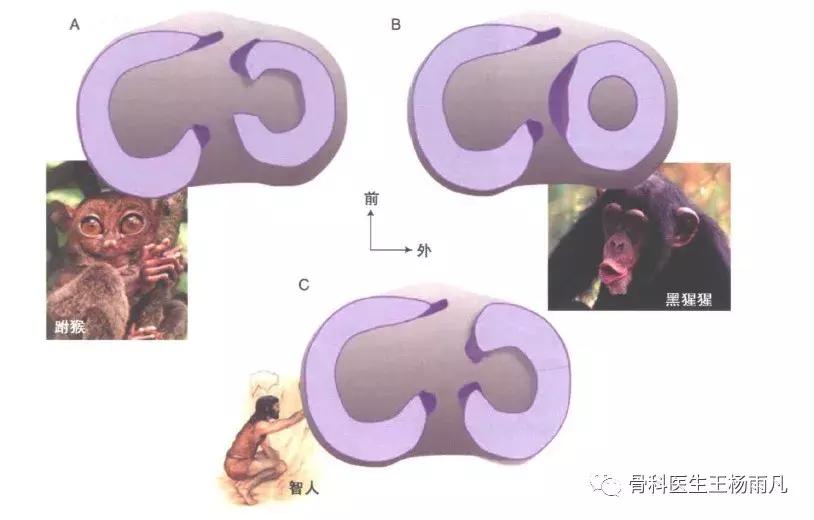 关于半月板的正确说法,半月板前世是什么