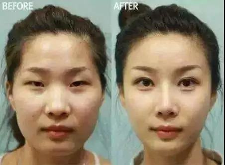 再见代购的意思,再见代购再见微商