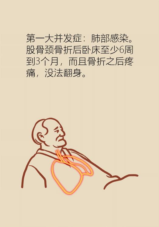 老人股骨颈骨折后死亡率高达50%，提醒爸妈一定要注意！