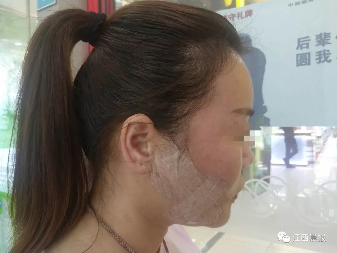 花6万整容,花6万整容认清现实