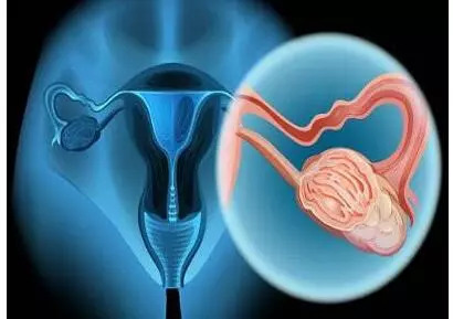 视频|海外就医新体验:保留生育功能,妇科肿瘤如何治疗