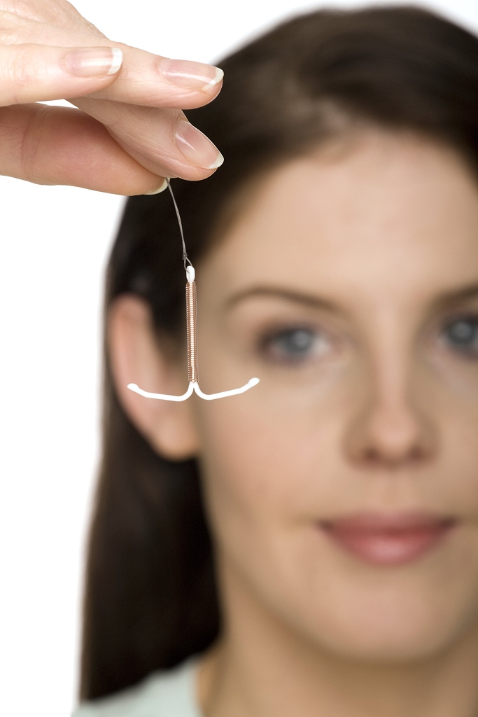 节育环哪种副作用最小,节育环哪种不容易炎症