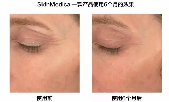 一支冻干粉6瓶精华,一支冻干粉6瓶精华液