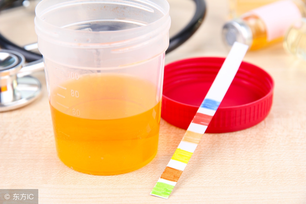 脚后跟痛是不是痛风警惕四种病,脚后跟痛风一直疼怎么处理