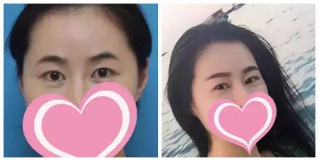 雾状眉跟仿真眉的区别,雾状眉和丝状眉哪个好