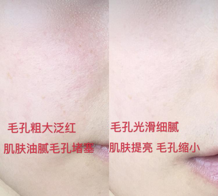 真的火了很多年的luna洁面仪,luna洁面仪韩国版