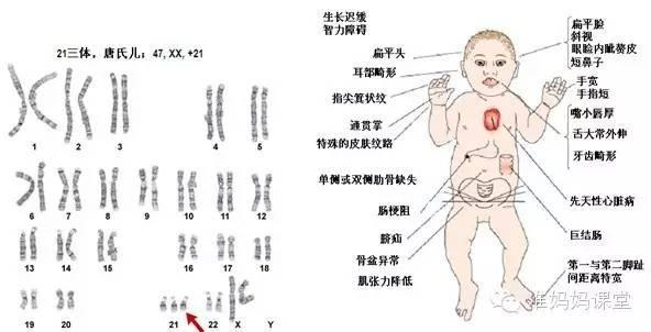 唐筛到底有多可怕,为啥每个人做唐筛都是不好的