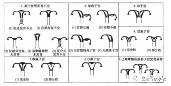 怀孕子宫畸形,畸形率高97%可以自然怀孕吗