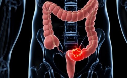 患癌必死吗,患癌有可能身体正常吗