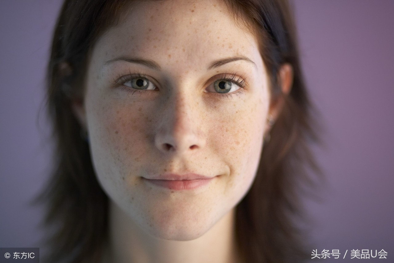 斑点为什么会长,为什么斑点很难去除
