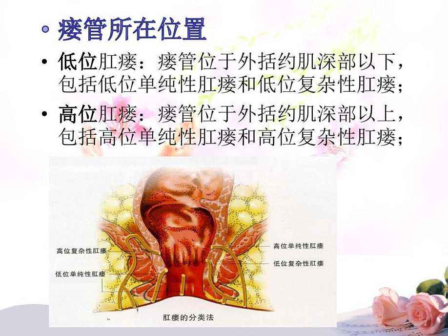 国庆节送医生什么礼物,探望肛瘘病人送什么礼物