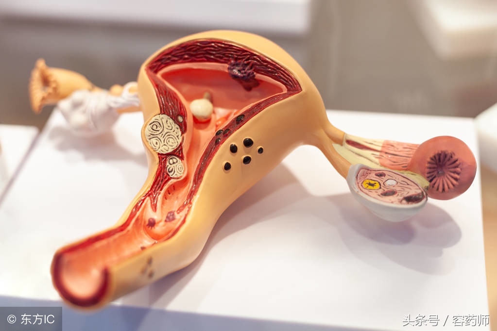 子宫切除绝经后有宫颈息肉怎么办,子宫息肉7x5mm要做宫腔切除吗