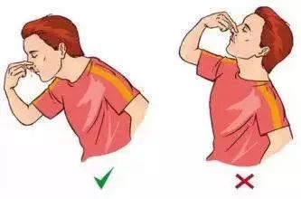 如何捏鼻子让鼻梁变高,经常捏鼻子能使鼻梁变高吗