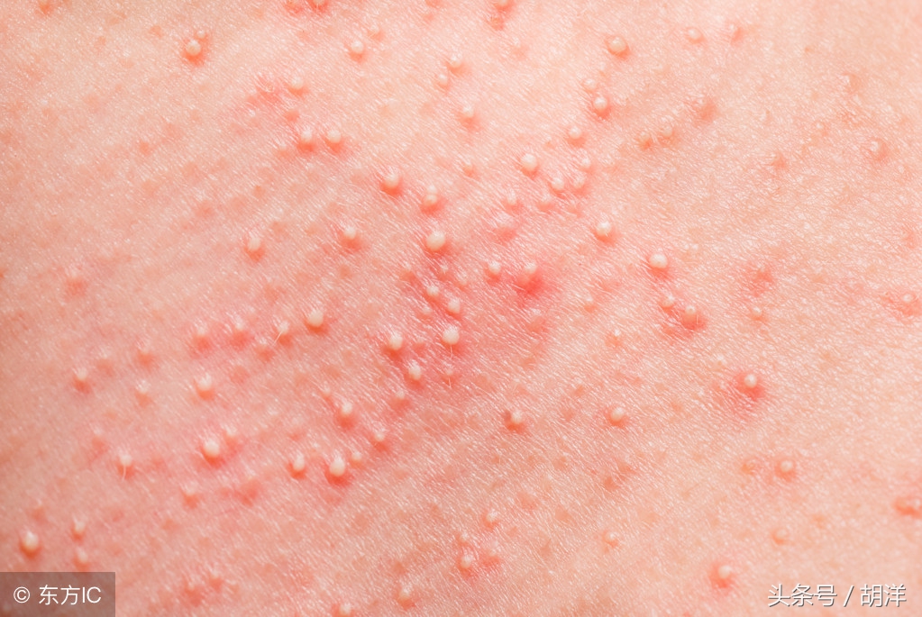 癌症吃靶向药有哪些副作用,吃癌症靶向药有什么副作用吗