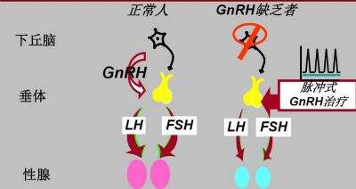 不孕不育不排卵怎么办,不排卵怎么治好