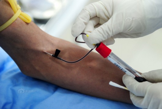 我的血为什么颜色老是特别黑,我的血为什么是黑红色的