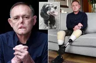 又一例！他严重感染四肢被截，竟只因被狗狗舔了一下……