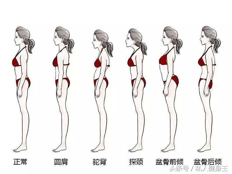 怎么才能快速有效的改变骨盆前倾,导致骨盆前倾的不良坐姿有哪些