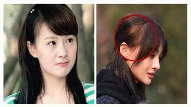 一个方法判断你是否有脱发,造成脱发的原因无非就这5个