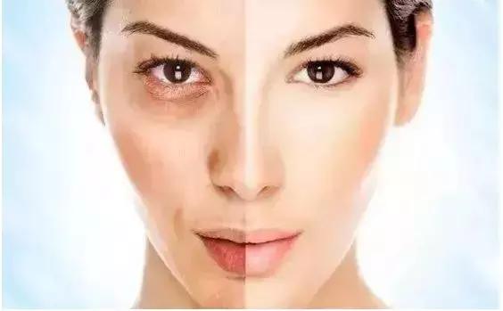 换季秋日肌肤焕活,秋日护肤水润先行