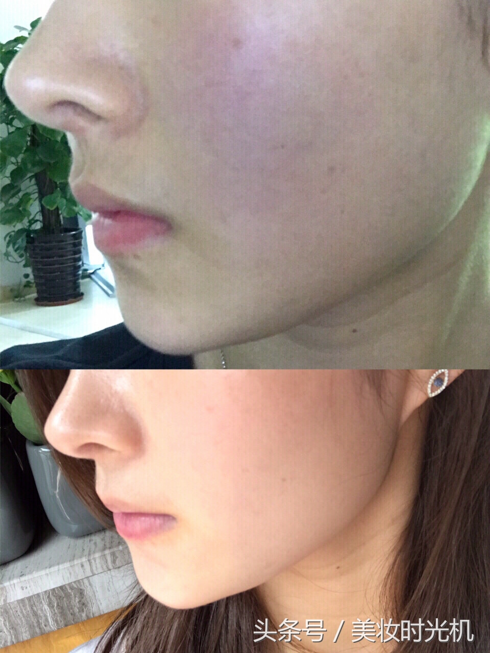 医美面膜敏感肌选哪一款,20款面膜使用感合集