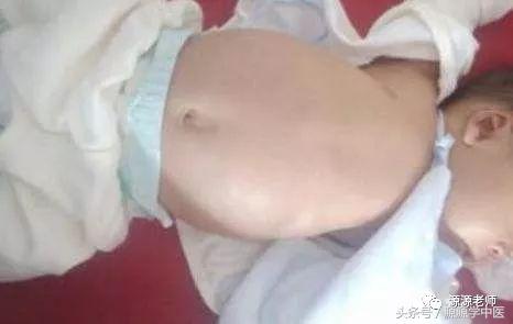 15天宝宝肚子胀气如何快速消除,2岁宝宝肚子鼓鼓的胀气怎么处理