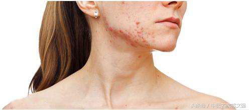 老中医告诉你湿气怎么回事,中医讲寒湿西医讲什么