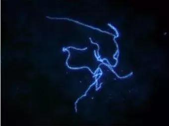 两美女合租一间房得了一样的病！胳膊上都长了奇怪形状的疹子