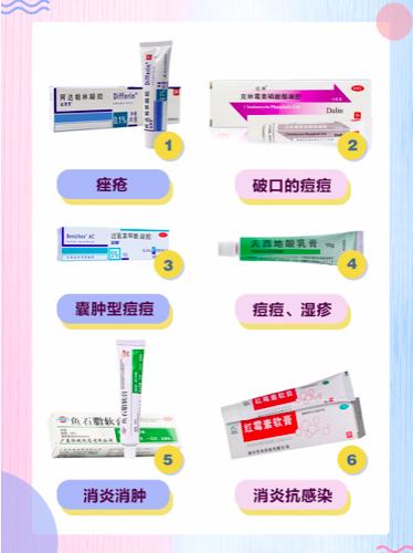 各类药膏治疗痘痘,痘印痘坑药膏大全