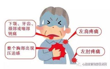 心绞痛的治疗方法有哪些医问医答,心绞痛按手部哪个穴位