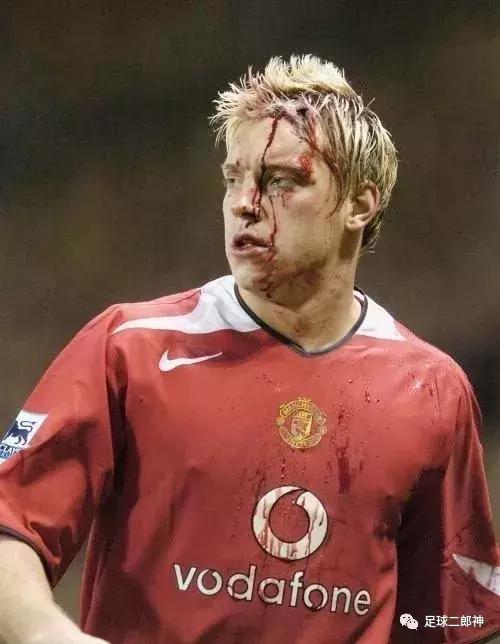 为曼联踢断腿的男人,为曼联付出一切的球员