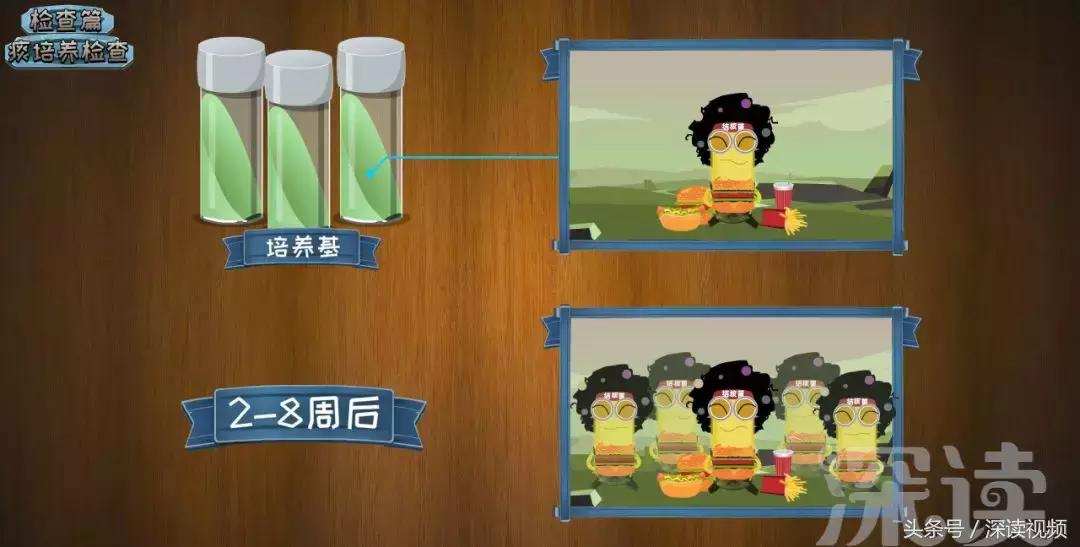 咳嗽低烧37.1-37.5要警惕,咳嗽低烧警惕四种病