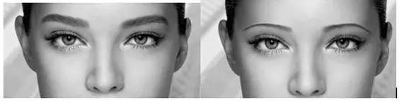 眉毛多有没有必要做眉毛,眉毛做不好看了还能改吗